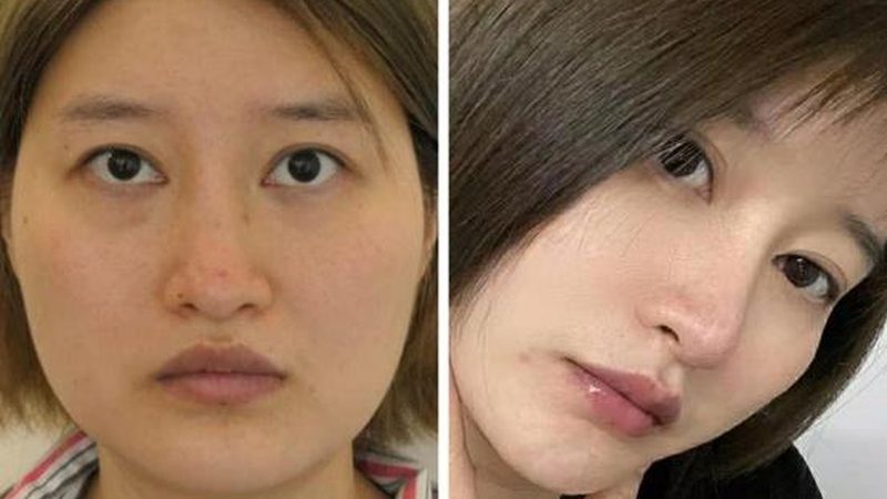 医美咨询师证书考试时间揭秘：何时报名，如何备考