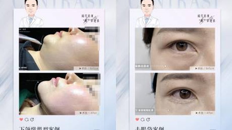成都轻医美操作流程揭秘：注意事项与专业解析