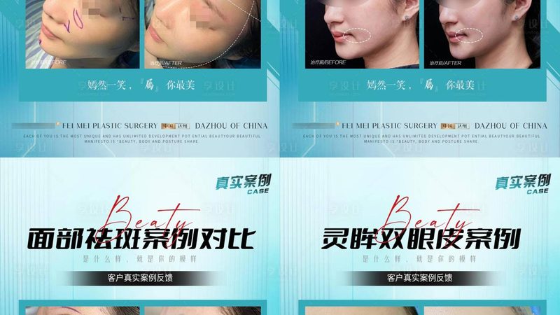 瘦脸瑜伽，轻松塑造精致小脸教程
