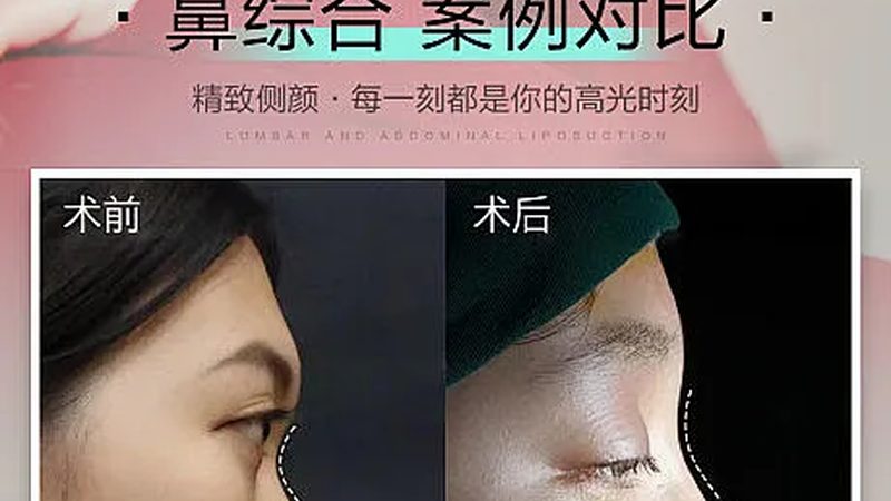 轻医美和医美怎么选最合适