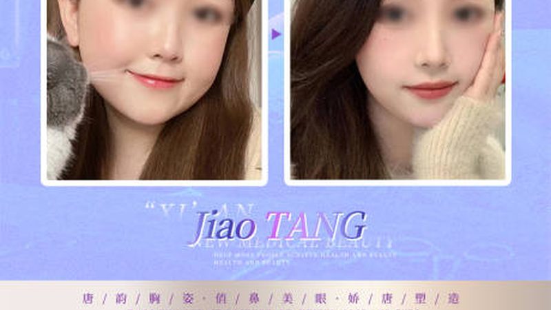 瘦脸绷带：原理与效果
