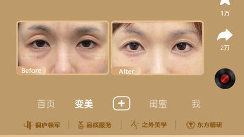 热玛吉VS线雕：揭秘两种抗衰老技术的本质区别