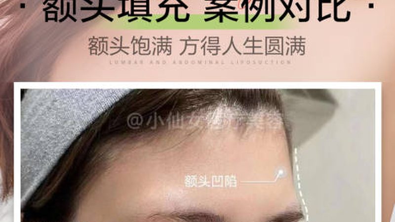 医美失败修复，加盟代理的流程揭秘