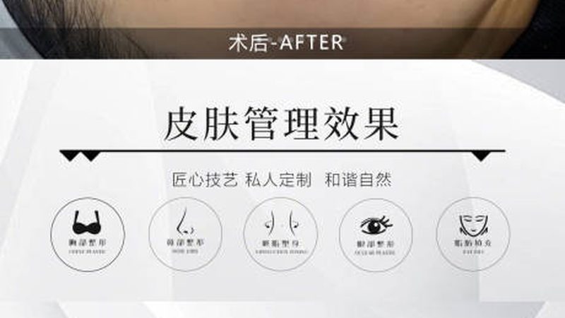 轻医美产品OEM定制，厂家到底在做什么