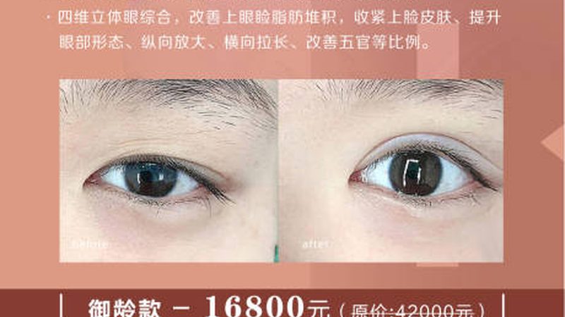 北京面部整形医院排名，揭秘如何挑选优质机构