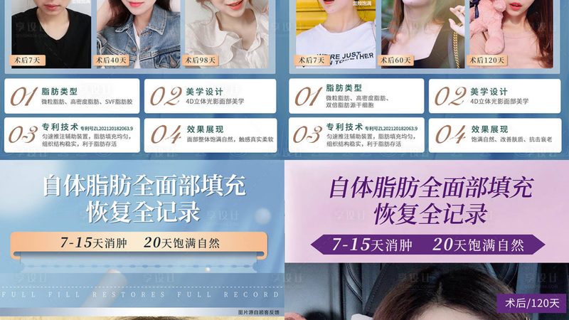 成都超声炮医院面诊，这些步骤你不可不知