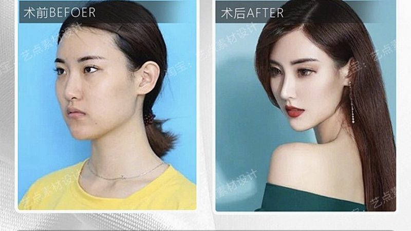 轻医美原料OEM定制，揭秘定制背后的秘密