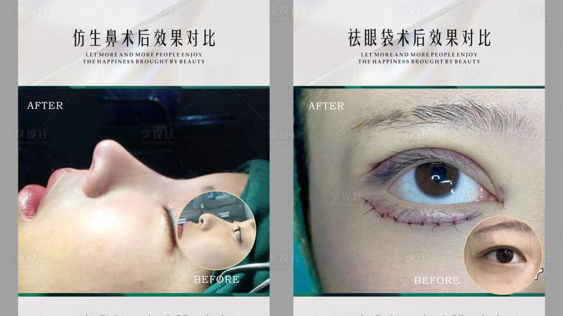 玻尿酸，如何辨别真伪？北京哪里买正品？**