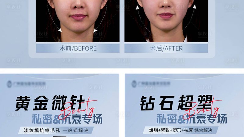 玻尿酸国产进口怎么选注意事项