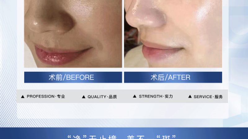 超声炮：揭秘其使用流程与步骤**