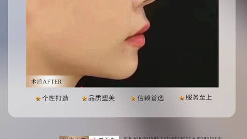美容院采购超声炮仪器注意事项