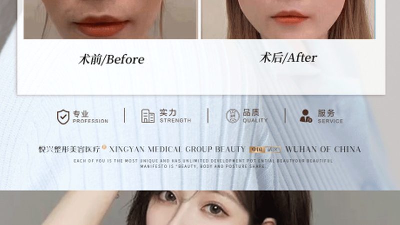 抗衰产品如何挑选？揭秘四大误区