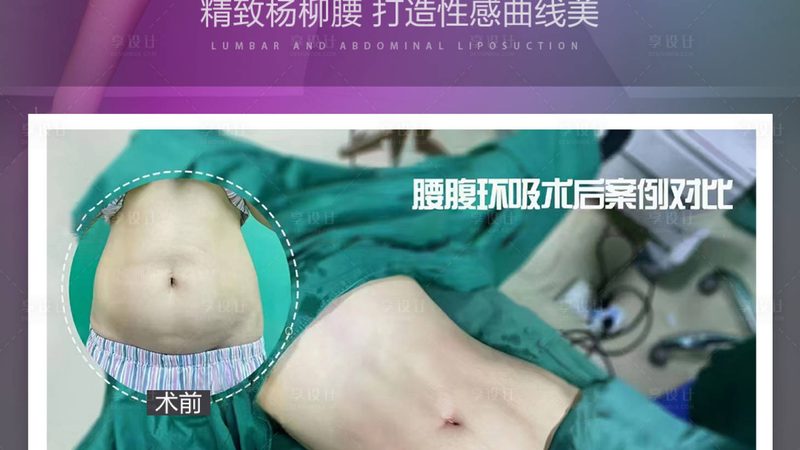 注射美容，哪些人群不宜尝试？**