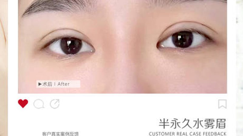 成都瘦腿针，你了解多少？**