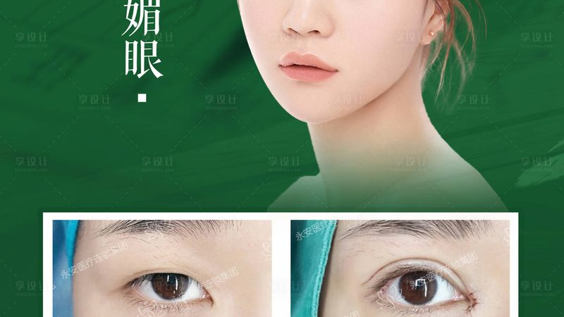 成都医美价格贵不贵有议价空间吗